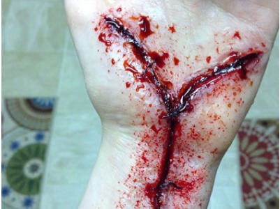 Bloody hobby shocks friends, family